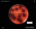 listeria on palcam